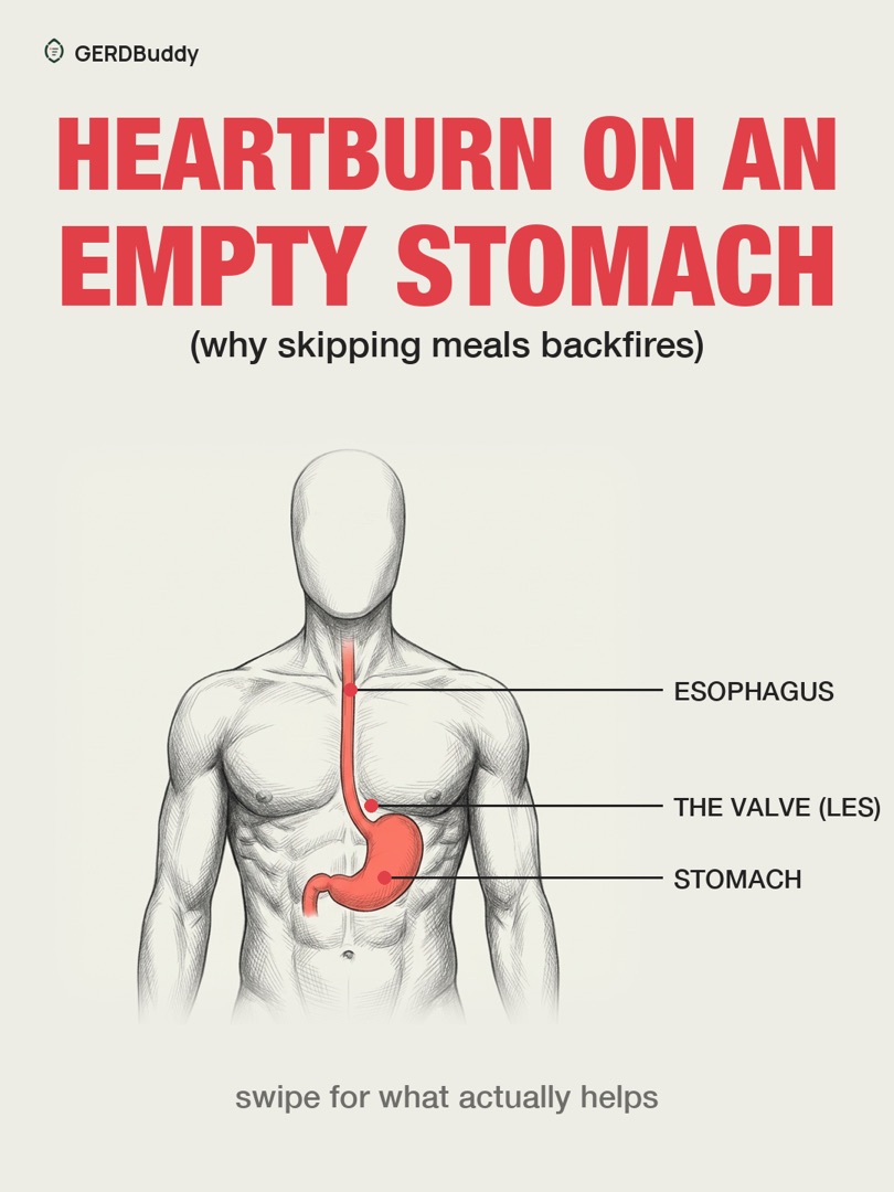 Heartburn on an empty stomach