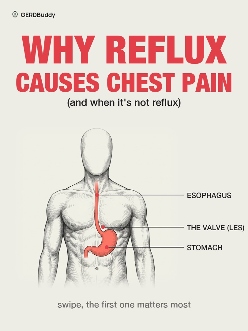 Why reflux causes chest pain