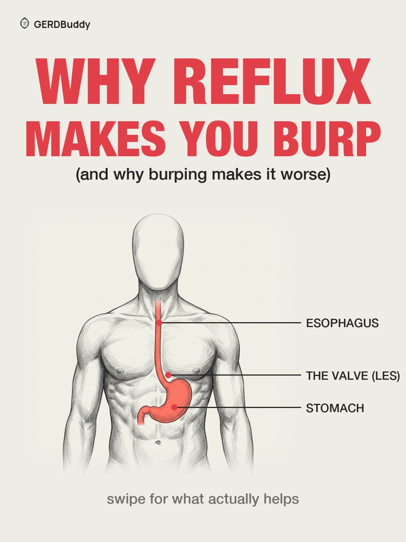 Why reflux makes you burp